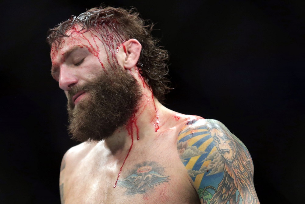 Michael Chiesa kitálalt McGregor-ék támadásáról